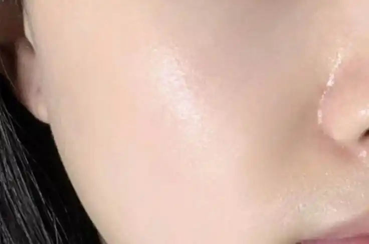 Skin Texture After Treatment