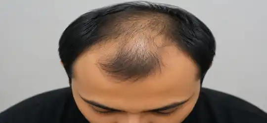 Before Hair Treatment