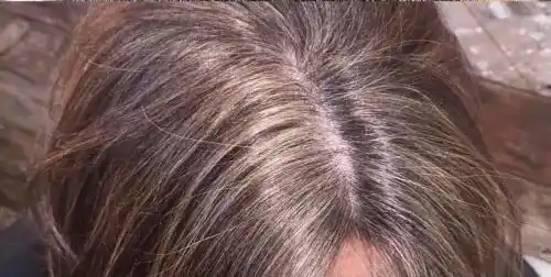 Post-Treatment Stabilization
