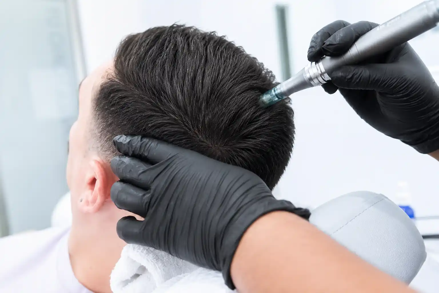 Improved Hair Density Follow up