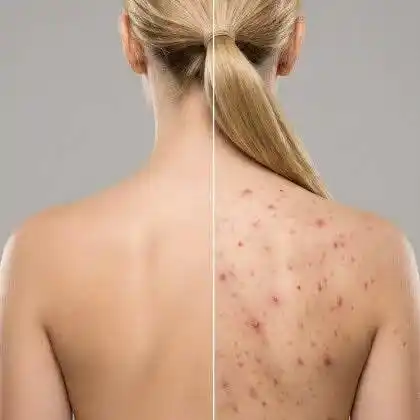Body Scar