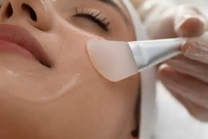 Peels