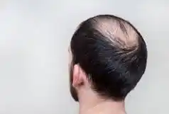 Combination Therapy