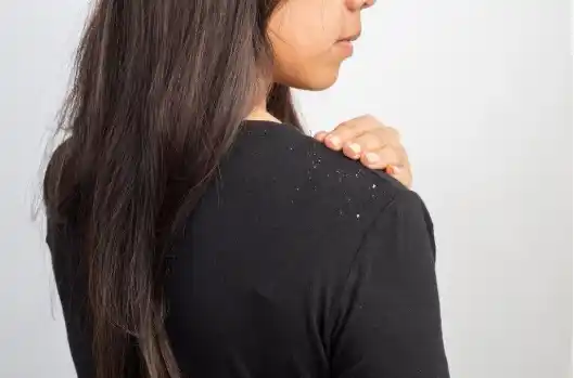 Sunburn tan removal