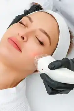 Facial Hair Removal
