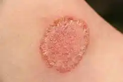 Combo
