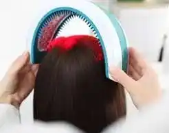 Hair Transplant