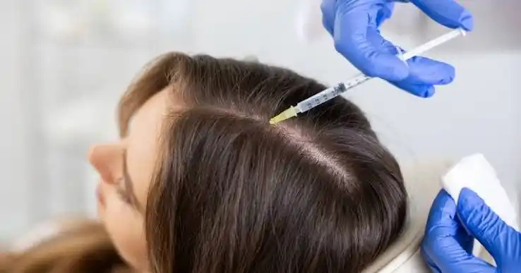 PRP Therapy