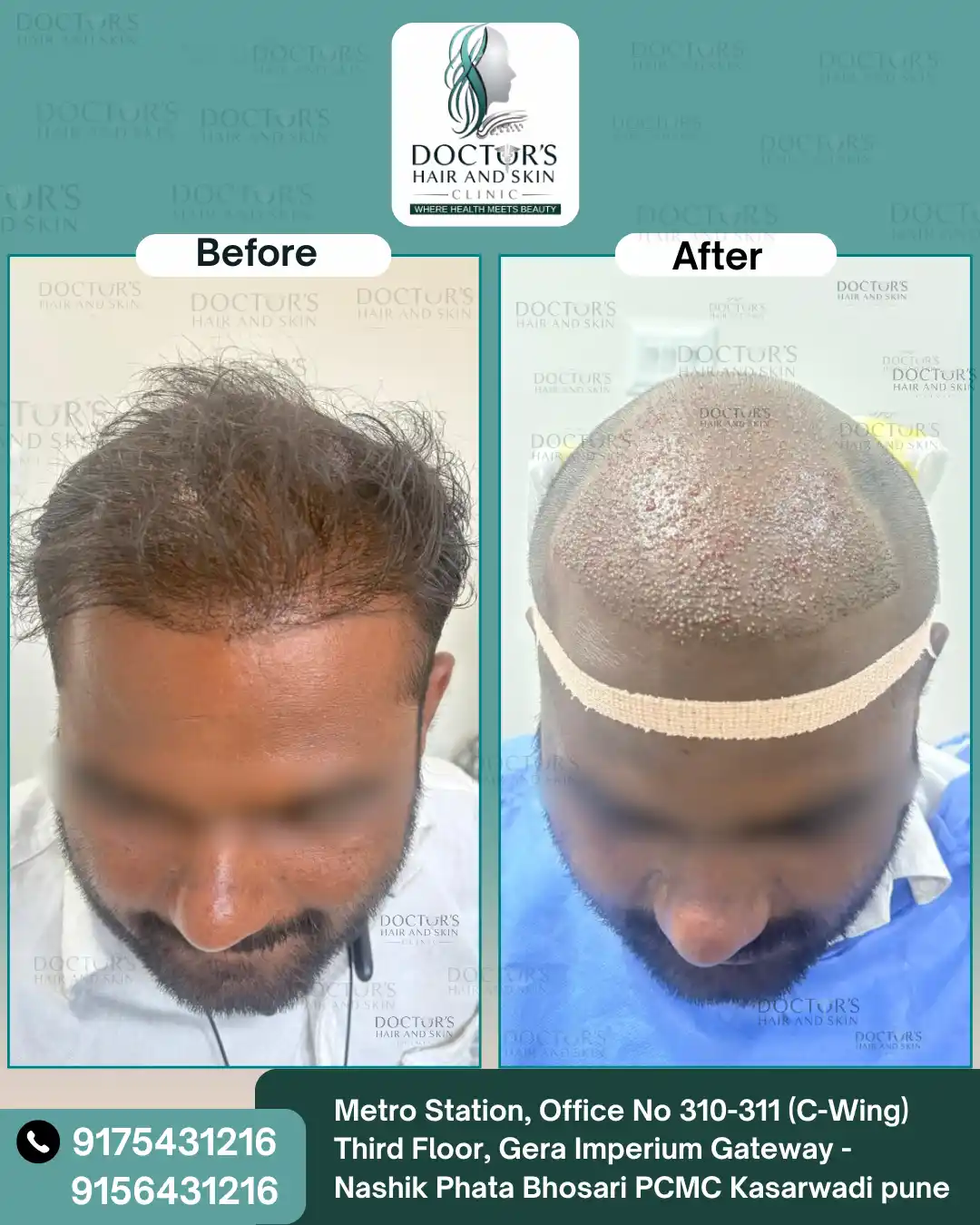 Before and After Result 3