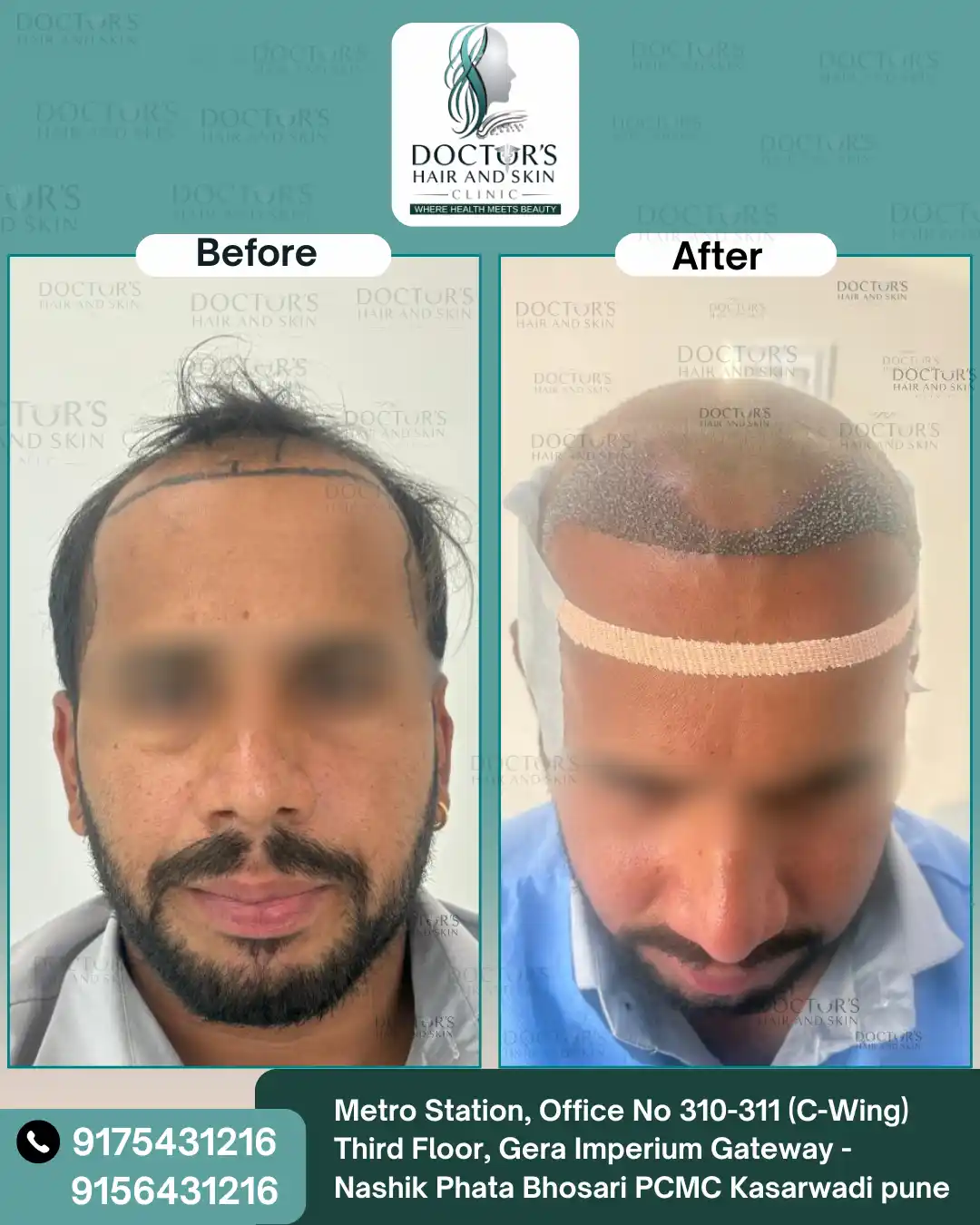 Hair Result 7