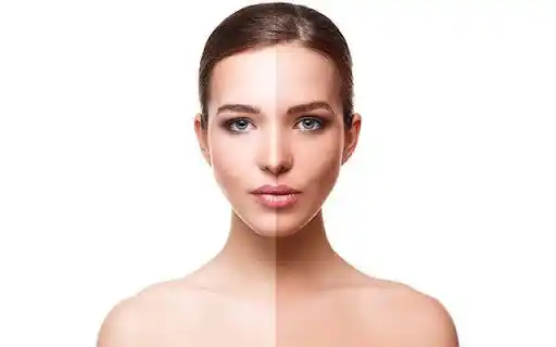 Sunburn tan removal